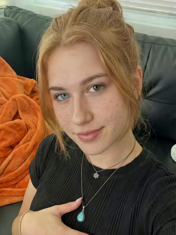 Rotköpfin mit heterochromen Augen flirtet im Chat